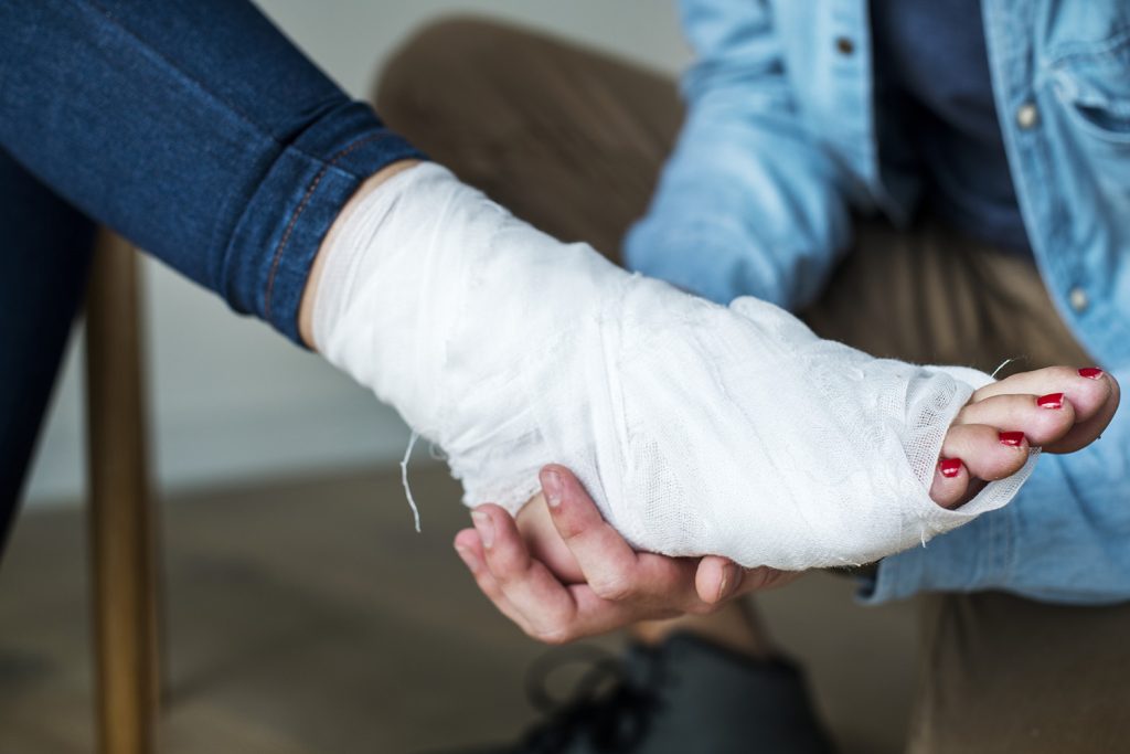 When does a fracture need surgery and when can it be managed without surgery? 2 When a fracture needs surgery